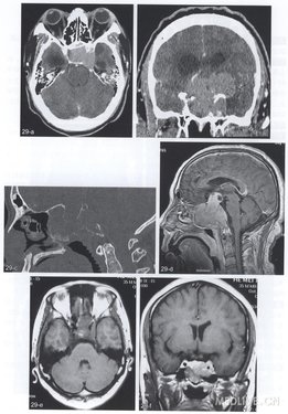 http://webres.medlive.cn/upload/000/078/898