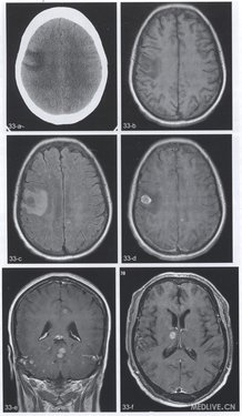 http://webres.medlive.cn/upload/000/078/927
