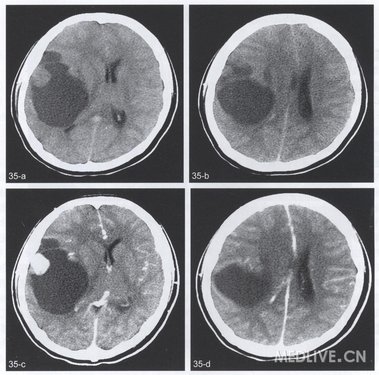http://webres.medlive.cn/upload/000/078/934