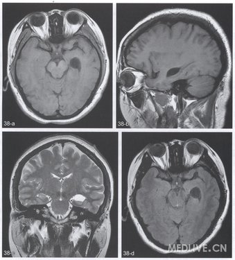 http://webres.medlive.cn/upload/000/078/945
