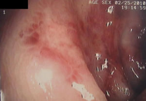 http://webres.medlive.cn/upload/000/081/810