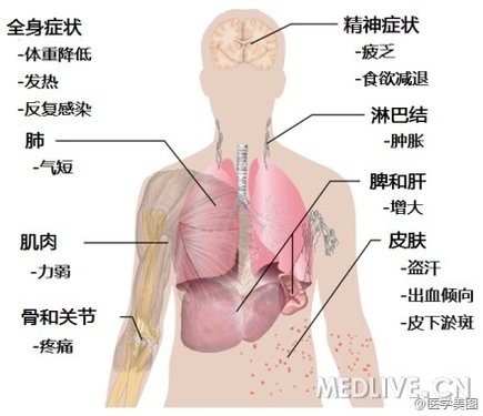 http://webres.medlive.cn/upload/000/082/856
