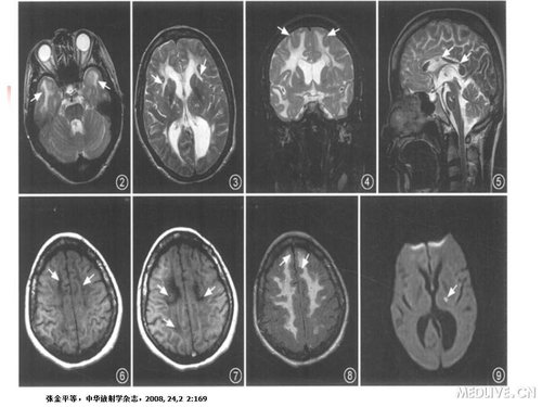 http://webres.medlive.cn/upload/000/089/425