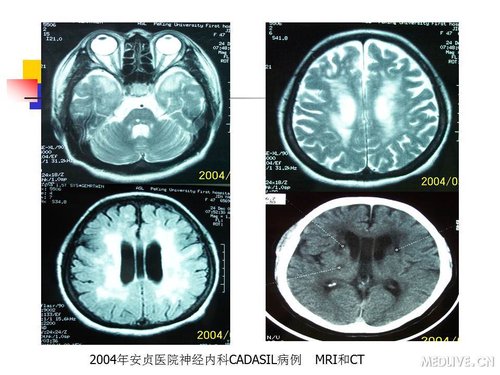 http://webres.medlive.cn/upload/000/089/426