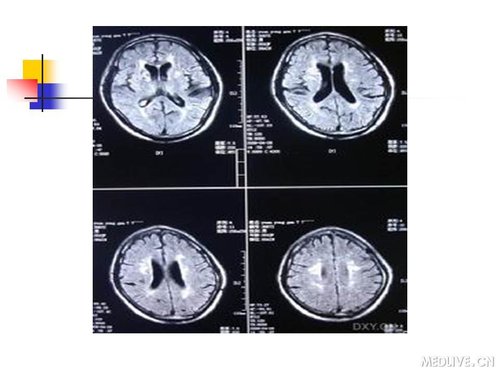 http://webres.medlive.cn/upload/000/089/427