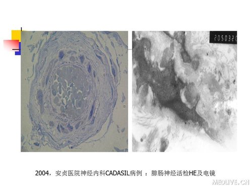 http://webres.medlive.cn/upload/000/089/429