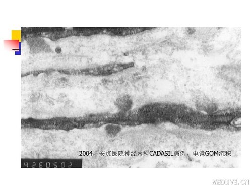 http://webres.medlive.cn/upload/000/089/430