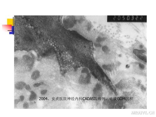 http://webres.medlive.cn/upload/000/089/431