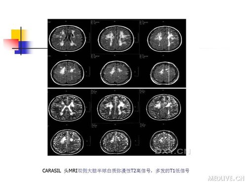 http://webres.medlive.cn/upload/000/089/444
