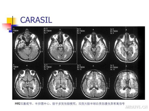 http://webres.medlive.cn/upload/000/089/445