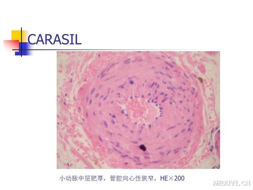 http://webres.medlive.cn/upload/000/089/447