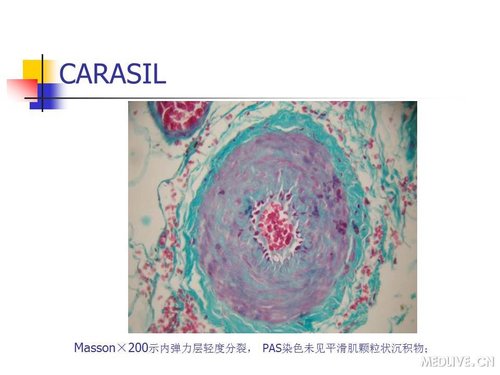 http://webres.medlive.cn/upload/000/089/448