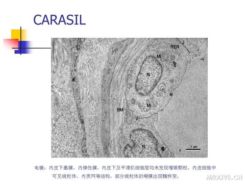 http://webres.medlive.cn/upload/000/089/450