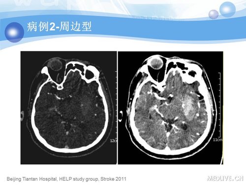 http://webres.medlive.cn/upload/000/090/346