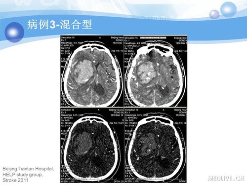 http://webres.medlive.cn/upload/000/090/347