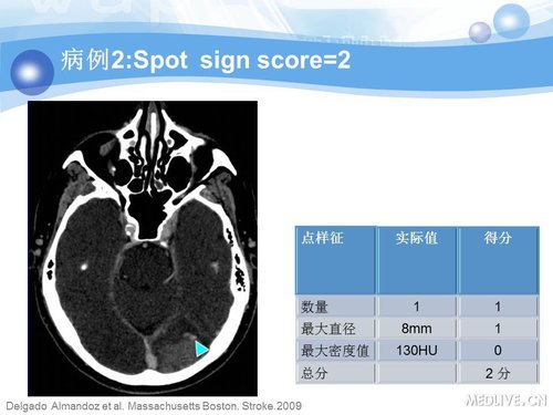 http://webres.medlive.cn/upload/000/090/355