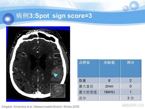 http://webres.medlive.cn/upload/000/090/356