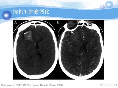 http://webres.medlive.cn/upload/000/090/359