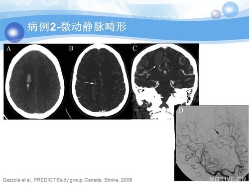 http://webres.medlive.cn/upload/000/090/360