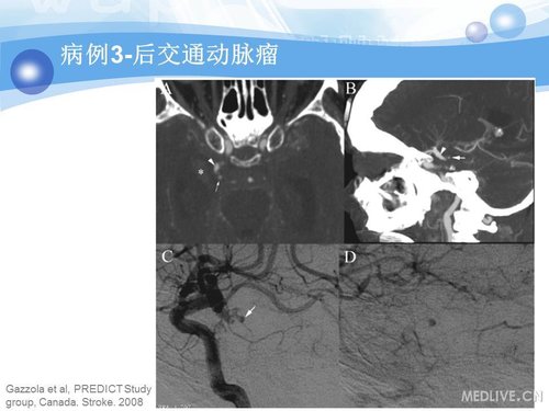 http://webres.medlive.cn/upload/000/090/361