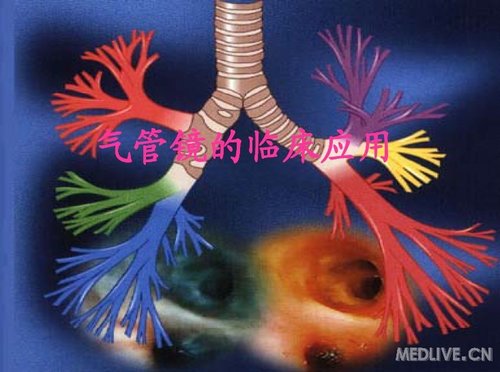 http://webres.medlive.cn/upload/000/097/611