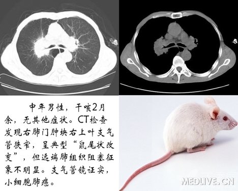 http://webres.medlive.cn/upload/000/102/282