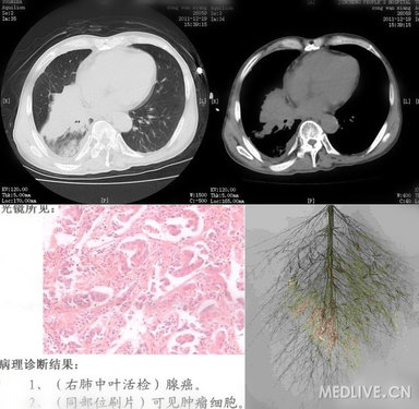 http://webres.medlive.cn/upload/000/102/283