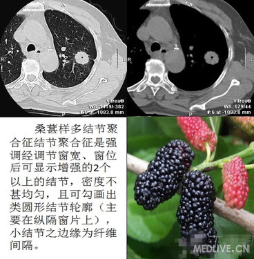 http://webres.medlive.cn/upload/000/102/285
