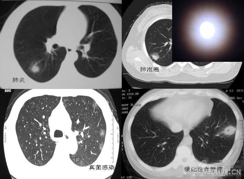 http://webres.medlive.cn/upload/000/102/289