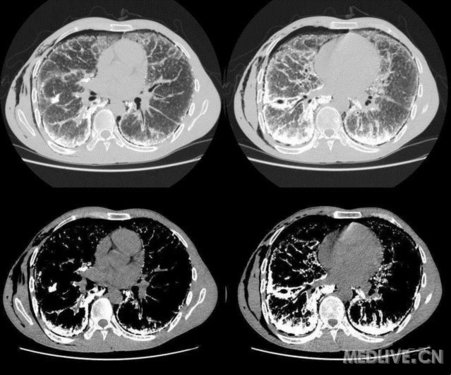 http://webres.medlive.cn/upload/000/102/292
