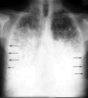 http://webres.medlive.cn/upload/000/102/293