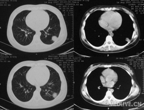 http://webres.medlive.cn/upload/000/102/295