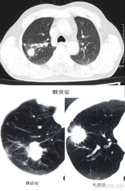 http://webres.medlive.cn/upload/000/102/301
