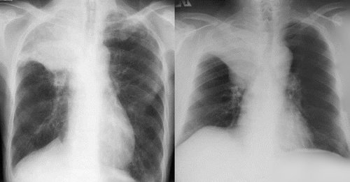 http://webres.medlive.cn/upload/000/102/313