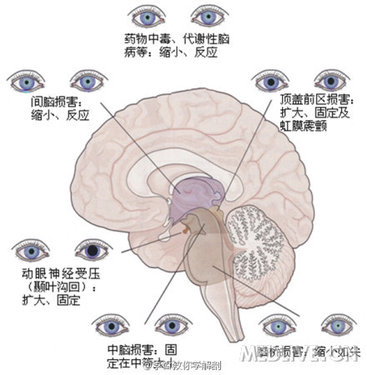 http://webres.medlive.cn/upload/000/104/352