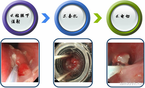 http://webres.medlive.cn/upload/000/105/447