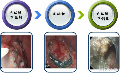 http://webres.medlive.cn/upload/000/105/450