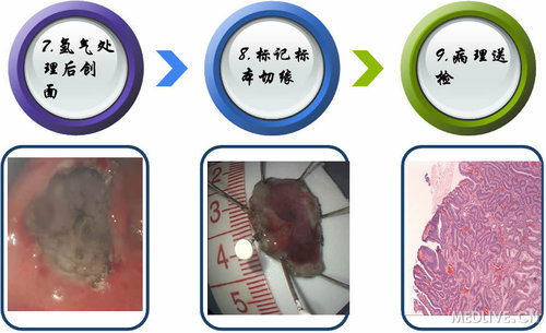 http://webres.medlive.cn/upload/000/105/451