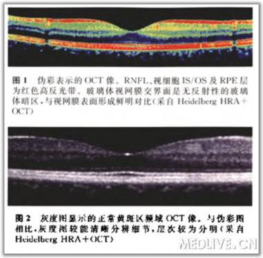 点击查看原图 http://webres.medlive.cn/upload/000/105/798