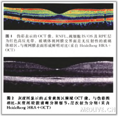 http://webres.medlive.cn/upload/000/105/798