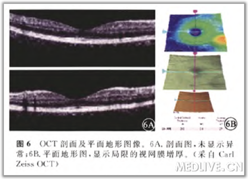 点击查看原图 http://webres.medlive.cn/upload/000/105/801