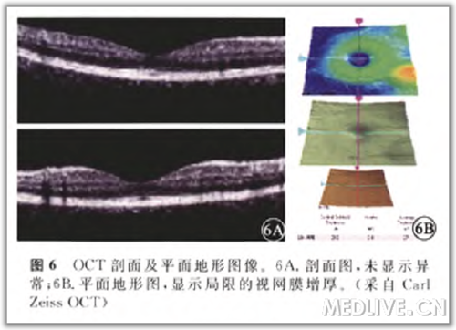 http://webres.medlive.cn/upload/000/105/801