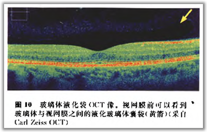 http://webres.medlive.cn/upload/000/105/807