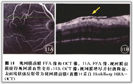 点击查看原图 http://webres.medlive.cn/upload/000/105/808