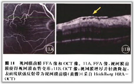 http://webres.medlive.cn/upload/000/105/808