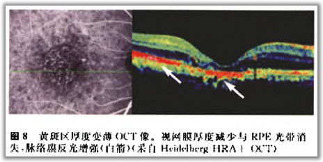 http://webres.medlive.cn/upload/000/105/810