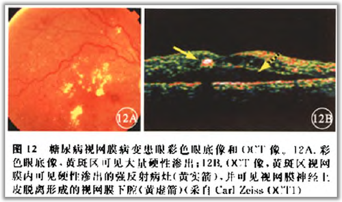 http://webres.medlive.cn/upload/000/105/816