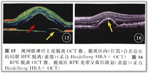 http://webres.medlive.cn/upload/000/105/820