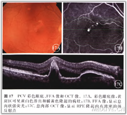 点击查看原图 http://webres.medlive.cn/upload/000/105/822