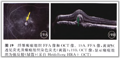 http://webres.medlive.cn/upload/000/105/824